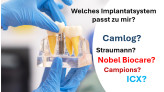 Implantathersteller im Vergleich. Welches Implantat passt zu mir?